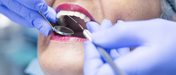Best Emergency Dentist for Knocked-Out Tooth in Alexandria, IN